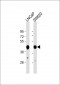 CS Antibody (N-term)
